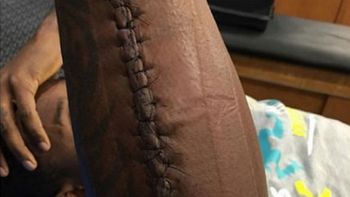 impresionante: jugo el super bowl con el brazo quebrado impresionante: jugo el super bowl con el brazo quebrado