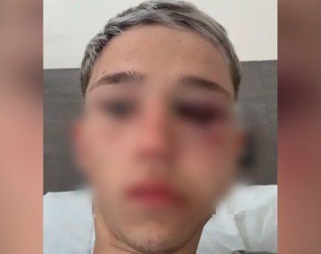 Estremecedor audio de uno de los rugbiers: Le agarré la cabeza y le di con la rodilla