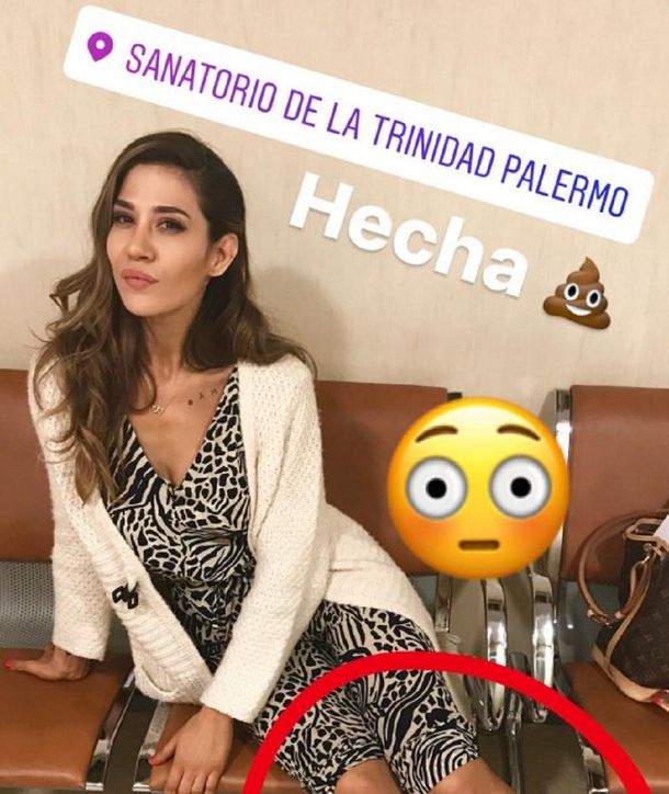 Los moretones que le dejó la salsa de a tres a Jimena Barón