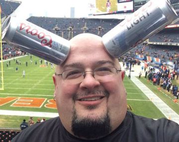 Un hombre puede adherir latas a su cabeza gracias a un extraño fenómeno