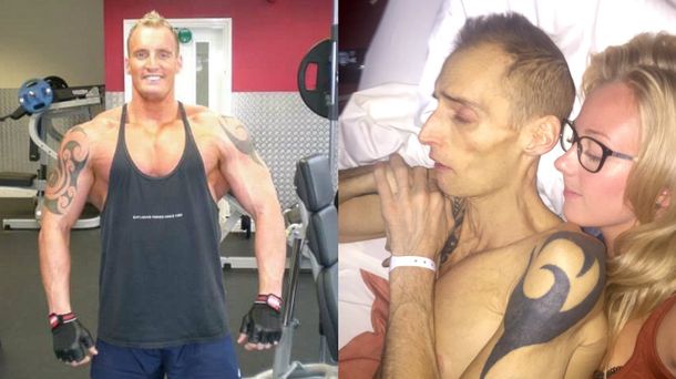 Un fisicoculturista mostró su dramática transformación debido al cáncer