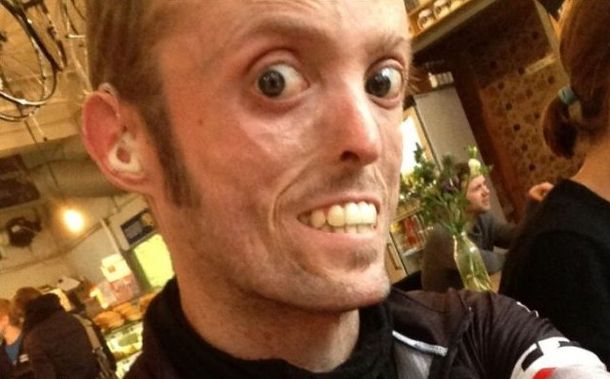 Científicos investigan a un hombre que no puede engordar