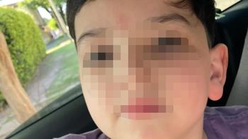 parte medico: confirman que bastian tiene lesiones cerebrales y cervicales severas parte medico: confirman que bastian tiene lesiones cerebrales y cervicales severas