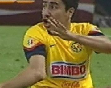 La terrible lesión de un jugador en el fútbol mexicano