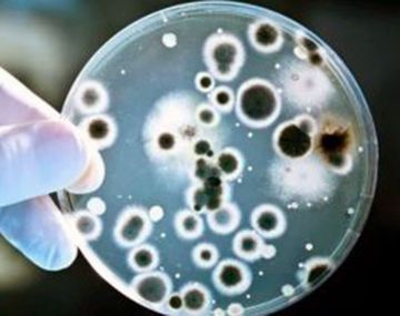 Qué es el Streptococcus Pyogenes