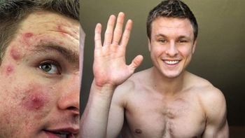 El antes y después de Brian Turner El antes y después de Brian Turner