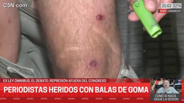 Represión en el Congreso: el periodista de C5N recibió dos balazos de goma