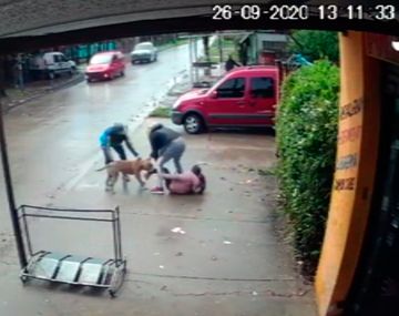 Imágenes sensibles: brutal ataque de un pitbull a una nena de 7 años en San Miguel