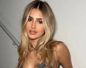 A Juli Poggio se le rompió un diente en vivo y enloqueció: Me quedó medio voladito