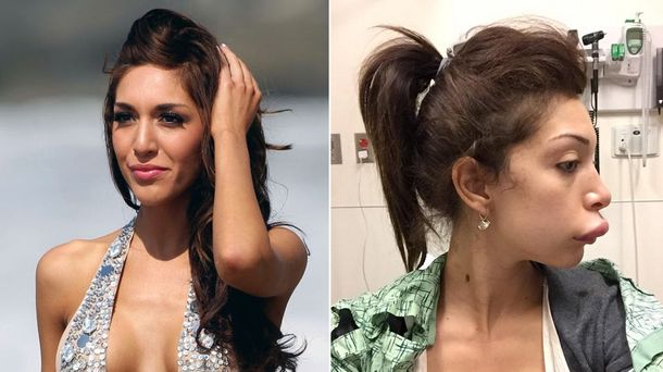 Una estrella de reality show fue víctima de mala praxis y lo mostró en la web