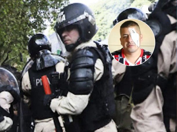 Descubren quién le disparó al manifestante que perdió la visión de un ojo en una marcha de jubilados