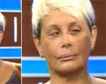 ¿Qué le pasó en el ojo a Carmen Barbieri?