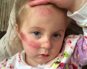 Ciclista atropelló a una nena y se escapó