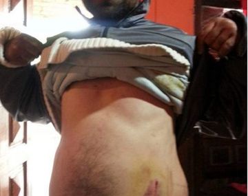 Rescatan a un hombre con retraso