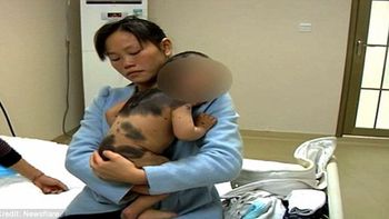 conmocion en china por un bebe que nacio cubierto de pelos conmocion en china por un bebe que nacio cubierto de pelos