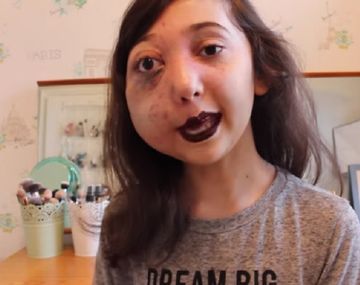 Youtuber inició una campaña por su enfermedad