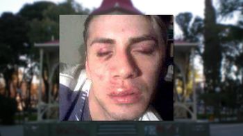 lo golpearon por ser gay a la salida de un boliche en trelew lo golpearon por ser gay a la salida de un boliche en trelew