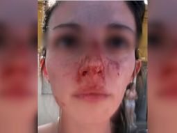 Brutal agresión a una mujer en Rosario: su ex la golpeó en la calle y delante de su hijo