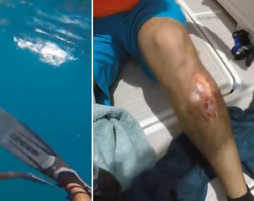 Un hombre sufrió el ataque de un tiburón en Key West