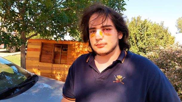 Imputaron a dos rugbiers por la feroz golpiza a un joven en Córdoba