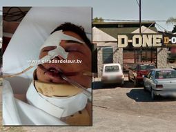 Salvaje golpiza de patovicas a un joven en un boliche de Florencio Varela