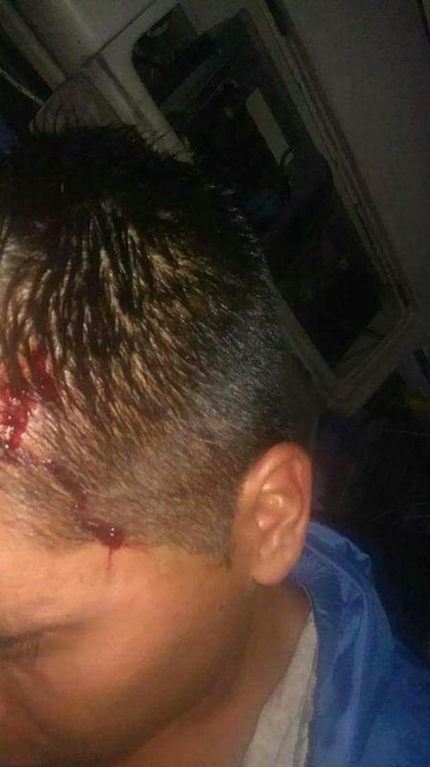 Así quedó el corte del conductor