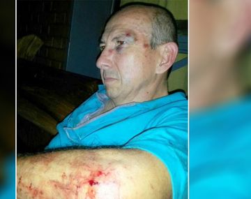 Le tocó bocina a un motociclista y recibió una brutal paliza