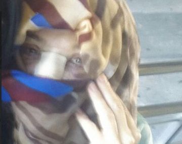 Así quedó Marcela Feudale después de la operación: las fotos