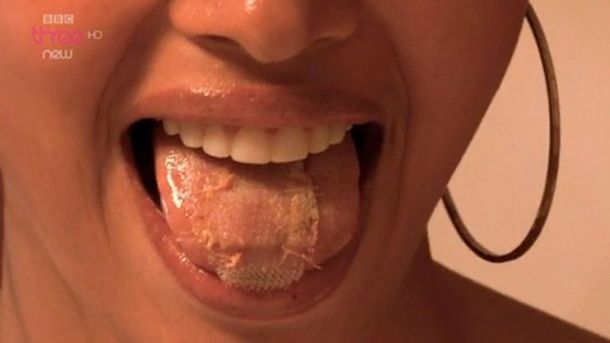 Modelos se cosen la boca para adelgazar y ganar un concurso