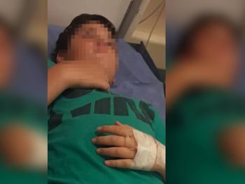 Un nene de 11 años sufrió una brutal golpiza en una escuela y fue internado