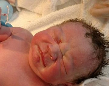 El bebe nació con el DIU en la mano