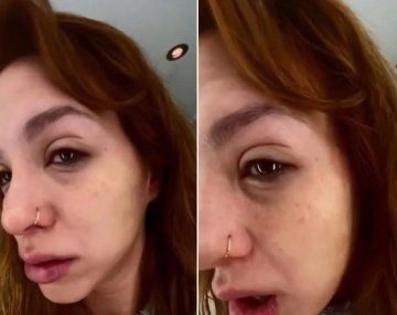 Una alergia le deformó la cara a Flor Vigna: las imágenes