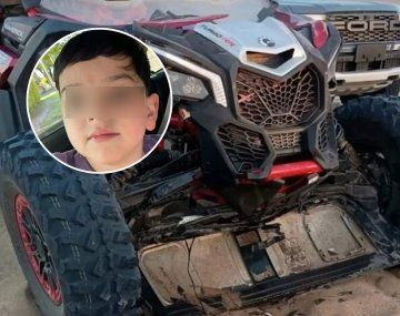 Mucha preocupación por Bastian: confirmaron que tiene múltiples fracturas en el cráneo