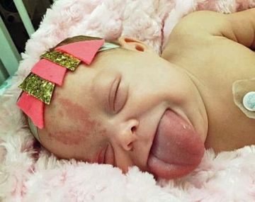 Paisley Morrison-Johnson, niña con lengua gigante