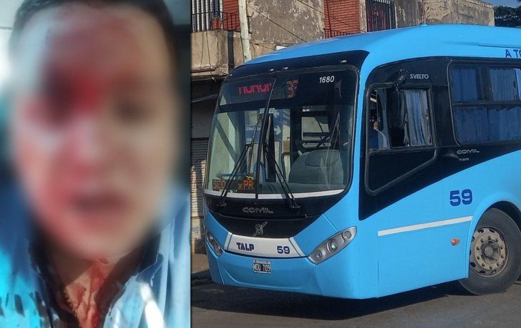 Brutal ataque en un colectivo: le partió una botella en la cabeza al chofer