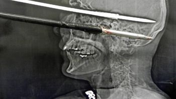 El hombre se salvó de milagro El hombre se salvó de milagro