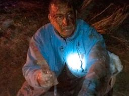 Luchó y mató a un puma para defender a su perro
