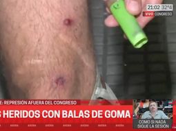 Represión en el Congreso: un periodista de C5N recibió dos balazos de goma