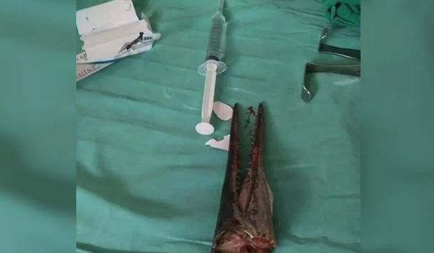 Un pez espada le atravesó el cuello mientras pescaba