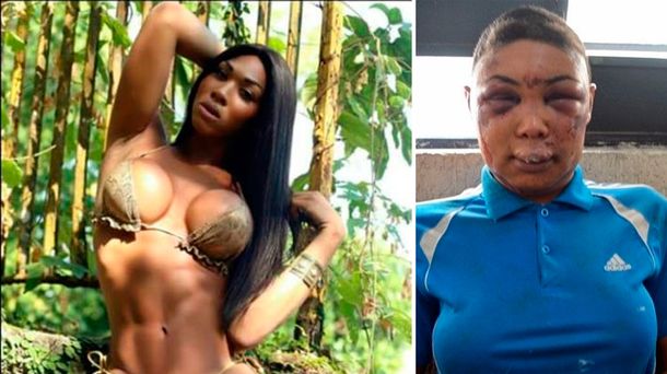 Conmoción por la trans desfigurada por la Policía de Brasil