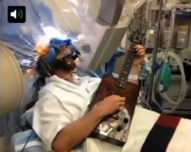 Un hombre toca la guitarra mientras le operan el cerebro