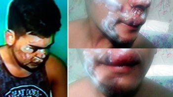 Así quedó Sergio luego de ser golpeado por un grupo de rugbiers Así quedó Sergio luego de ser golpeado por un grupo de rugbiers