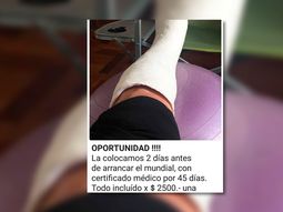 La mejor excusa para ver el Mundial desde tu casa: un yeso para faltar al trabajo