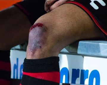 La impactante lesión de Bou que lo sacó de la cancha