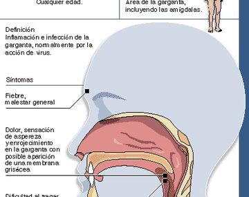 ¿Cómo es el cuadro de salud que padece la Presidenta?