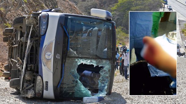 Así quedó el pie de Patricio Toranzo después del accidente