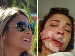 esta es la joven brutalmente agredida por patovicas esta es la joven brutalmente agredida por patovicas