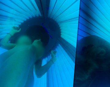 Llora Vicky Xipolitakis: se quemó en una cama solar