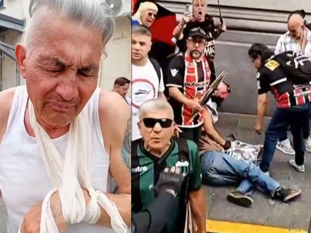 Habló el jubilado al que la Policía de Patricia Bullrich le quebró un brazo: Me tiraron como un misil