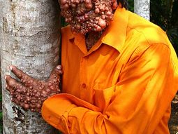 Chandra Wisnu, el hombre burbuja Chandra Wisnu, el hombre burbuja